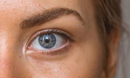 Pori Pori Wajah Membesar Akibat Kebiasaan Buruk Berikut Ini